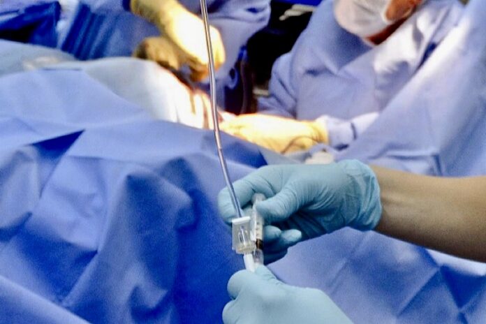 operazione